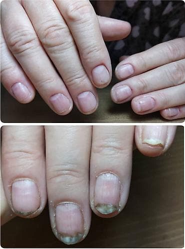 маникюр бишкек: ✨ Выездной мастер маникюра 🏙️ 🏡💖 Маникюр на дому 💰 Прайс: 🧼✨ — 10