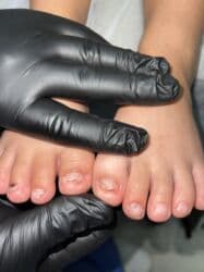 на дом керек: Услуги подолога, С выездом на дом, Консультация, Одноразовые расходные материалы — 12