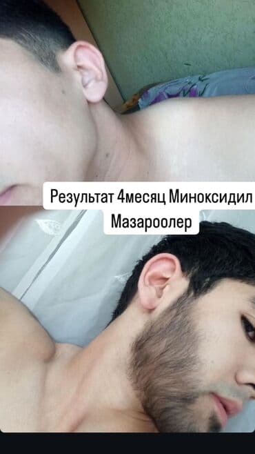 мужск: Миноксидил 5% для роста бороды + массажный дермароллер (указан как — 1