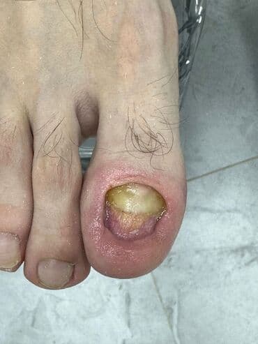 сколько стоит обучение на маникюр: Наращивание ногтей, Гель лак, шеллак, Укрепление ногтей, Услуги подолога, Маникюр, Педикюр, Консультация, Одноразовые расходные материалы — 6