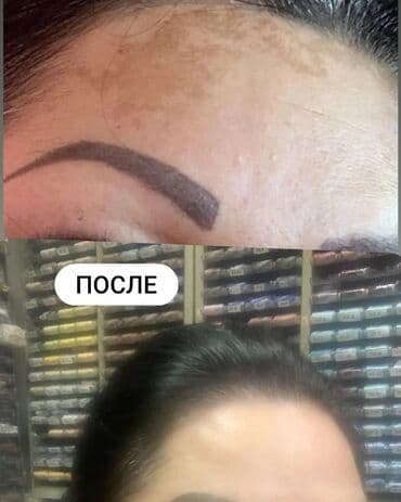 эффективный отбеливающий крем для зоны бикини в аптеке: Expigment Экспигмент Сроки до 2027 Свежая поставка с Турции 🇹🇷 💯% — 3