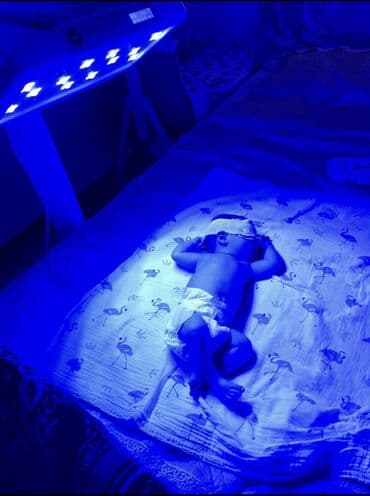 Кислородные концентраторы: Фотолампа.только у нас самые мощные и эффективные диодные фотолампы — 1