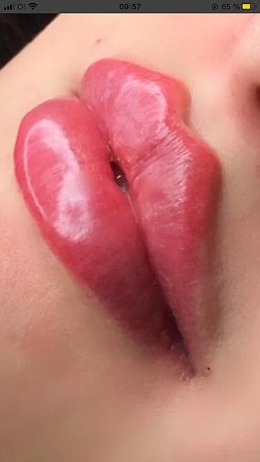 Косметология, Брыли, Ботокс, Биоревитализация, Консультация, Гипоаллергенные материалы, Сертифицированный косметолог