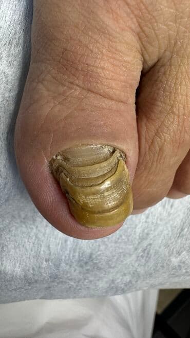 самый лучший эндокринолог рядом просп жибек жолу бишкек: Наращивание ногтей, Укрепление ногтей, Ремонт сломаных ногтей, Маникюр, Педикюр, С выездом на дом, Консультация, Одноразовые расходные материалы — 3