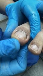 арендовать дом: Выравнивание, Услуги подолога, С выездом на дом, Консультация, Одноразовые расходные материалы — 38