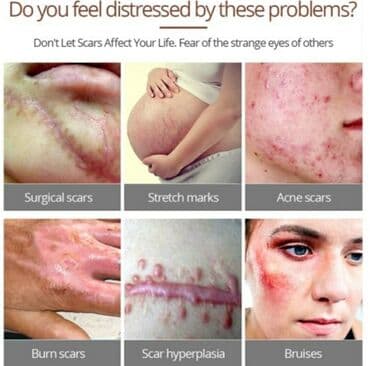 шампунь дисаар: Крем от производителей vibrant glamour, crocodile эффективно — 3