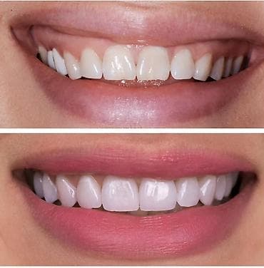 дедская одежда: ВСЕ ВИДЫ УСЛУГ СТАМОТОЛОГИИ !!!БЕСПЛАТНАЯ КОНСУЛЬТАЦИЯ!20% АКЦИЯ — 5