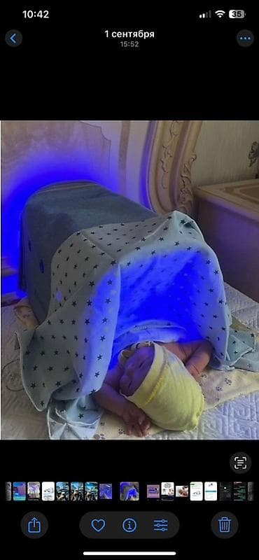 Мед. товарлар: Лампа для фототерапии новорождённых от желтушки (MAINENG) - Домашняя — 2