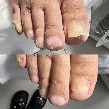 сапоги керза: Маникюр • Педикюр • Подология Профессиональный уход за руками и — 4