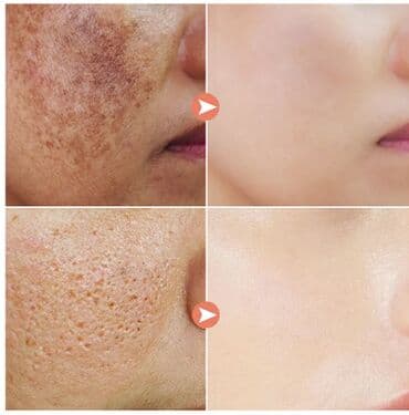 личный кабинет эрсаг кыргызстан: ❄️ США с Аmazon Walmart и Fruugo Крем консилер и осветлитель для лица — 20