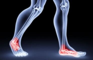 белорусская обувь для проблемных ног: Стельки ортопедические(специализированные) от плоскостопия! Для — 18