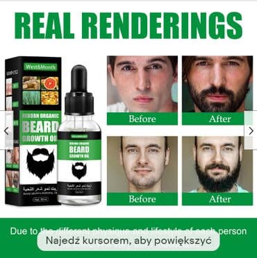 личный кабинет эрсаг кыргызстан: ❄️ США с Аmazon сыворотка для роста волос у мужчин и бороды для роста — 2