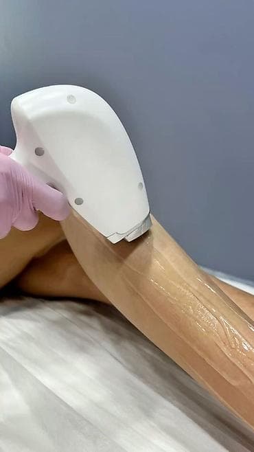 удаление папиллом бишкек отзывы: Лазерная эпиляция в Бишкеке ✨ 🤍 Аккуратно и без боли ✨ Подходит для — 1