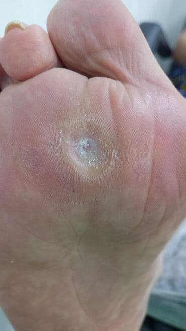 сколько стоит обучение на мастера маникюра: Коррекция вросших ногтей, Маникюр, Педикюр, Услуги подолога, Консультация, Одноразовые расходные материалы — 12