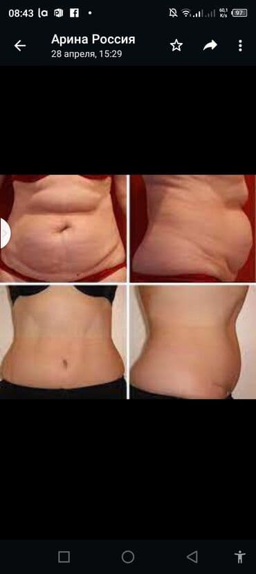 самый лучший эндокринолог рядом просп жибек жолу бишкек: Косметология, Ботокс, Восстановление объема губ, Лифтинг нити, С выездом на дом, Консультация, Гипоаллергенные материалы — 3