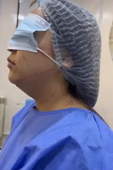 насадка пенис: 💎 ЭЭК АСТЫ ЖАНА ХОЛКА ЛИПОСАКЦИЯСЫ Акция! Акция! *Ээк асты – 25000с — 9