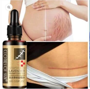 растяжки: Восстанавливающая эссенция LAVENDER . Масло для удаления растяжек и — 2