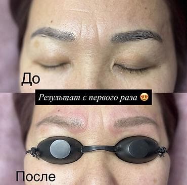 удаление татуажа ремувером: Мастер Альбина стаж работы 8 лет Услуги Пудровое напыление Удаления — 1