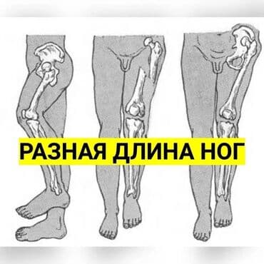 белорусская обувь для проблемных ног бишкек: Стельки для роста (7 видов) Цена за пару Адрес: Лермонтова — 10