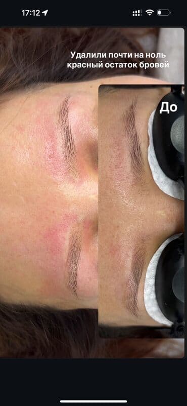 сколько стоит обучение на мастера маникюра: АКЦИЯ !АКЦИЯ! Новый метод удаления Сейчас по акции Лазерное удаление — 14