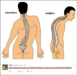 Глюкометры: Корсеты, корректоры осанки, пояса для спины, реклинаторы 9-11 — 2