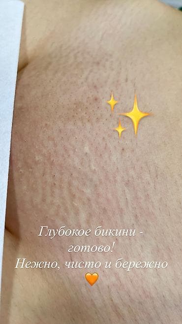 массаж озгон: Качественный бережный Шугаринг тела. Только для женщин . Цены на — 4