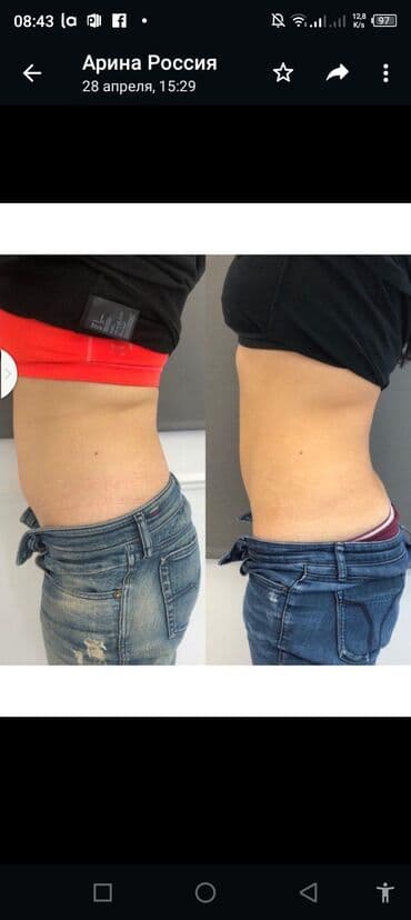 самый лучший эндокринолог рядом просп жибек жолу бишкек: Косметология, Ботокс, Восстановление объема губ, Лифтинг нити, С выездом на дом, Консультация, Гипоаллергенные материалы — 5