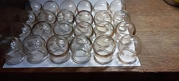 Отун: Стеклянные медицинские банки для вакуумной терапии/баночного массажа — 1