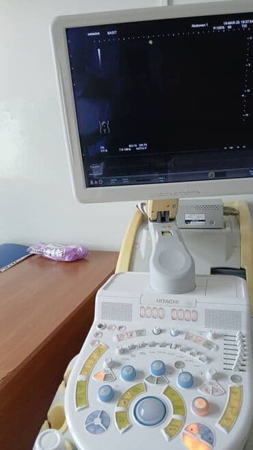 Кычкылтек жаздыктары: Продаю или сдаю УЗИ аппарат Хитачи Прейрус в отличном состоянии — 2