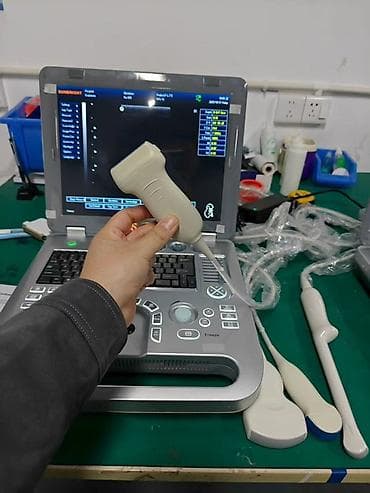 Ингаляторы, небулайзеры: Портативный ультразвуковой аппарат SUNBRIGHT (ноутбучный форм‑фактор) — 2