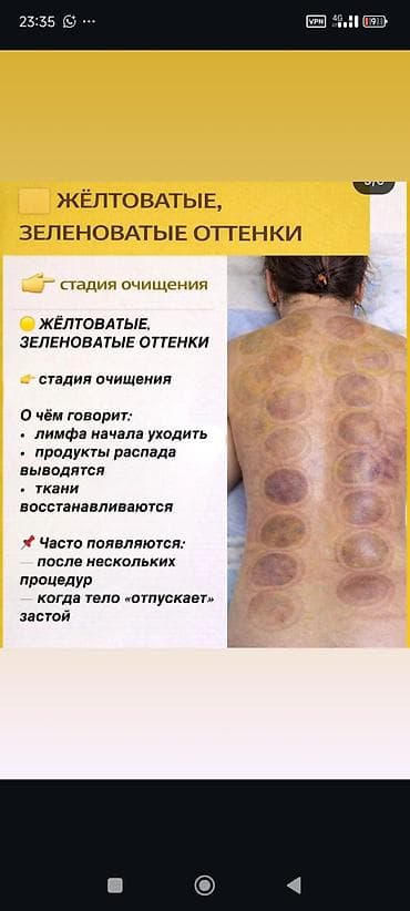 Массаж: Массаж | Сутулость, нарушение осанки — 2