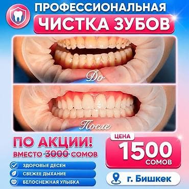 зуб: Профессиональная чистка зубов Акцияяя!!! Что входит: - Деликатное — 1
