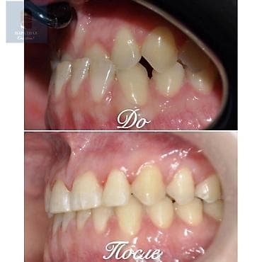 работа для врача: Ортодонтическое лечение: исправление прикуса и выравнивание зубных — 3
