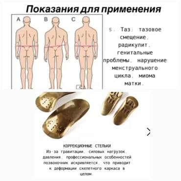 искры для обуви: Алтын батек кандайча иштейт? Гучженцзи ортопедиялык стелькилери — 9