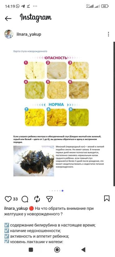 фотолампа для новорожденных: Сдается в аренду. Бесплатная консультация врача. доставка г.Бишкек — 6