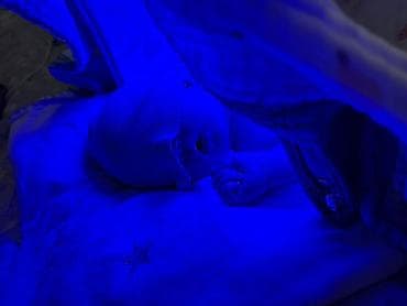 часы карта: Фотолампа от желтушки — 2