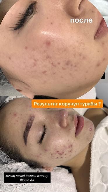 выезд массаж бишкек: МУЖСКАЯ И ЖЕНСКАЯ ПРОФЕССИОНАЛЬНАЯ ЧИСТКА Лица 1900сом 14 этапная — 5