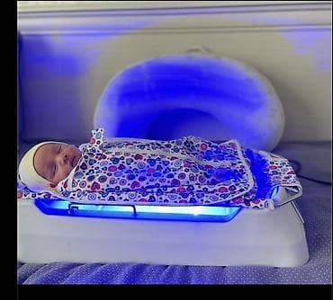 Медицинские лампы: Фотолампа от желтушки 👶 Аренда от --1000 сом в сутки .Консультация — 3