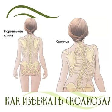 корректор осанки купить ош: Корсеты, корректоры осанки, пояса для спины, реклинаторы 9-11 lalafo.kg да — 1 корректор осанки купить ош: Корсеты, корректоры осанки, пояса для спины, реклинаторы 9-11 — 1