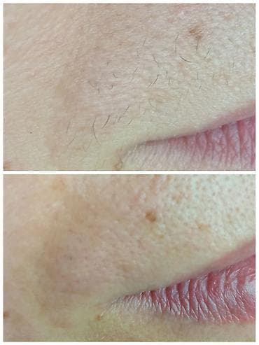 здаю салон красоты: Тридинг лица Тридинг — 10