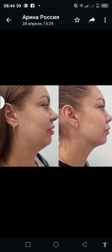 самый лучший эндокринолог рядом просп жибек жолу бишкек: Косметология, Ботокс, Восстановление объема губ, Лифтинг нити, С выездом на дом, Консультация, Гипоаллергенные материалы — 9