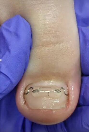 сколько стоит обучение на мастера маникюра: Выравнивание, Наращивание ногтей, Донаращивание ногтей, Маникюр, Педикюр, Услуги подолога, Консультация — 10