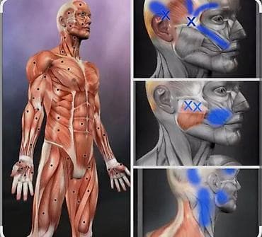 Массаж: Массаж | Сутулость, нарушение осанки | С выездом на дом, Консультация — 4