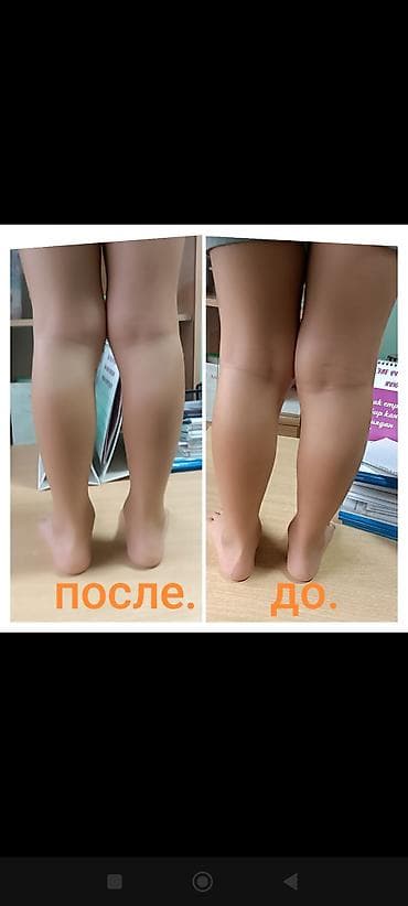 Массаж: Массаж | Детский массаж | Сутулость, нарушение осанки — 5