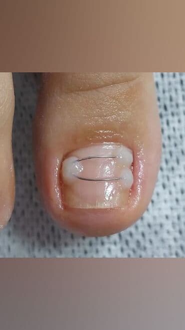 самый лучший эндокринолог рядом просп жибек жолу бишкек: Дизайн, Наращивание ногтей, Гель лак, шеллак, Маникюр, Педикюр, Услуги подолога, Консультация, Одноразовые расходные материалы — 3