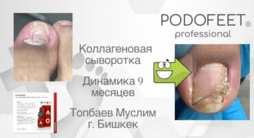 арендовать дом: Выравнивание, Услуги подолога, С выездом на дом, Консультация, Одноразовые расходные материалы — 13
