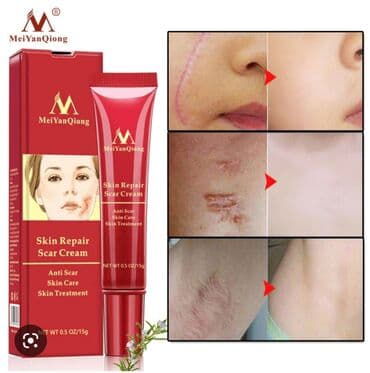 корейские капсулы день ночь отзывы: Крем от шрамов и рубцов. В состав входят мягкие натуральные — 1