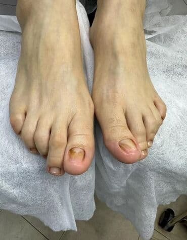 на дом керек: Услуги подолога, С выездом на дом, Консультация, Одноразовые расходные материалы — 8