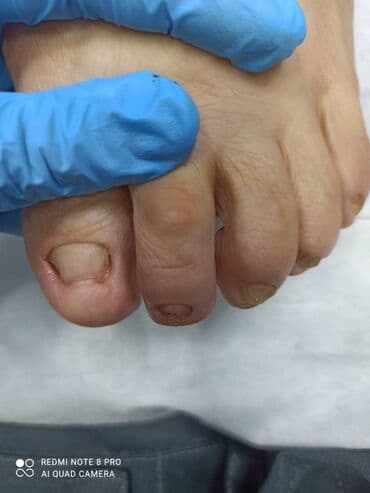 сколько стоит обучение на мастера маникюра: Выравнивание, Наращивание ногтей, Донаращивание ногтей, Маникюр, Педикюр, Услуги подолога, Консультация, Одноразовые расходные материалы — 2