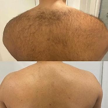 косметика б у: Депиляция теплым воском/шугаринг - Удаление нежелательных волос на — 5